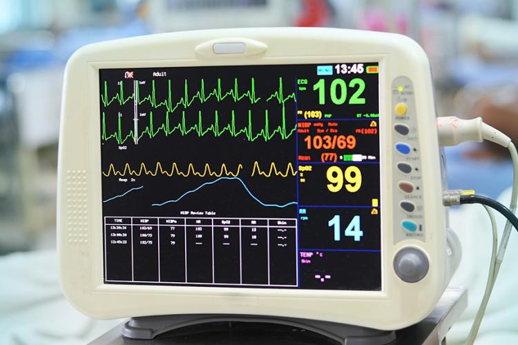 Monitor cardíaco, ¿qué es y cómo funciona?